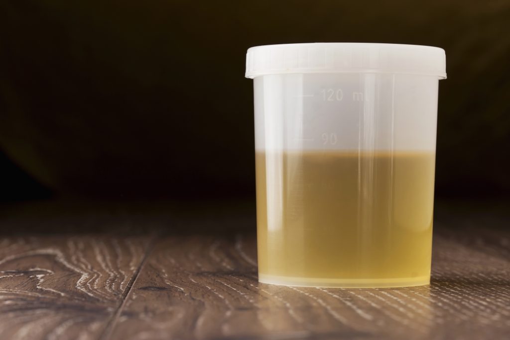proprietățile urinei